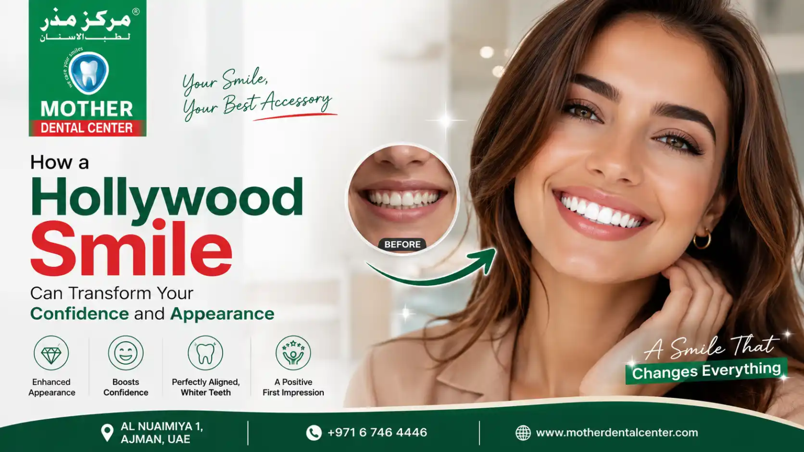 How a Hollywood Smile Can Transform Your Confidence and Appearance