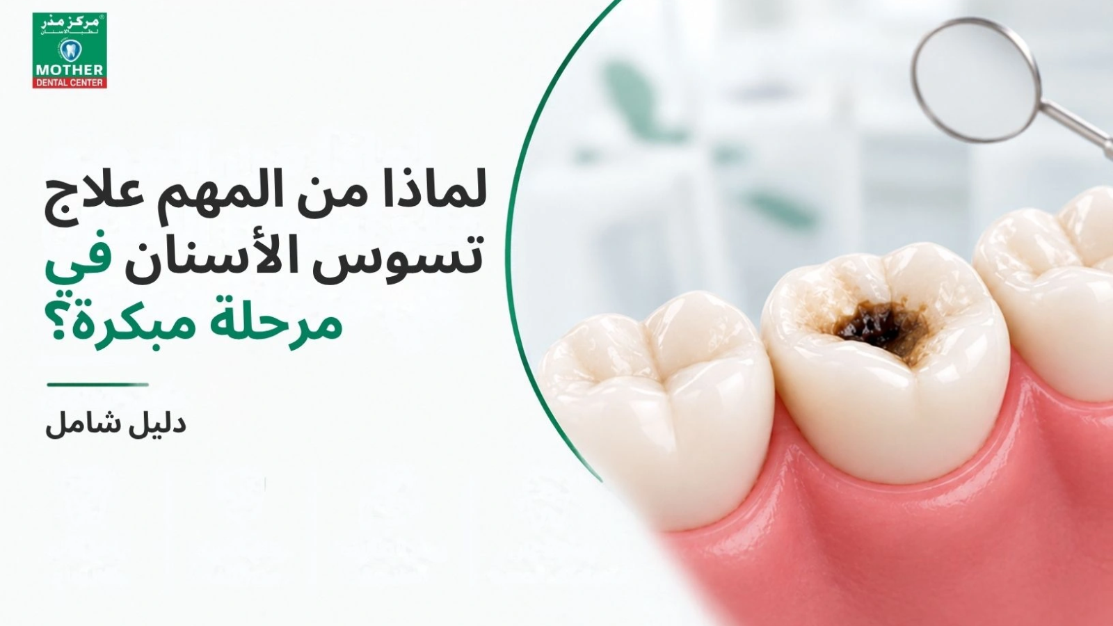 Cavity treatment ajman