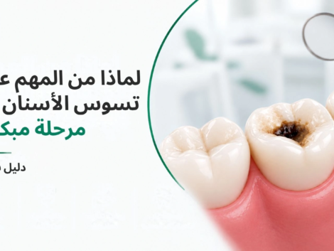 Cavity treatment ajman